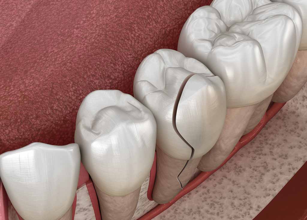 dental emergency content