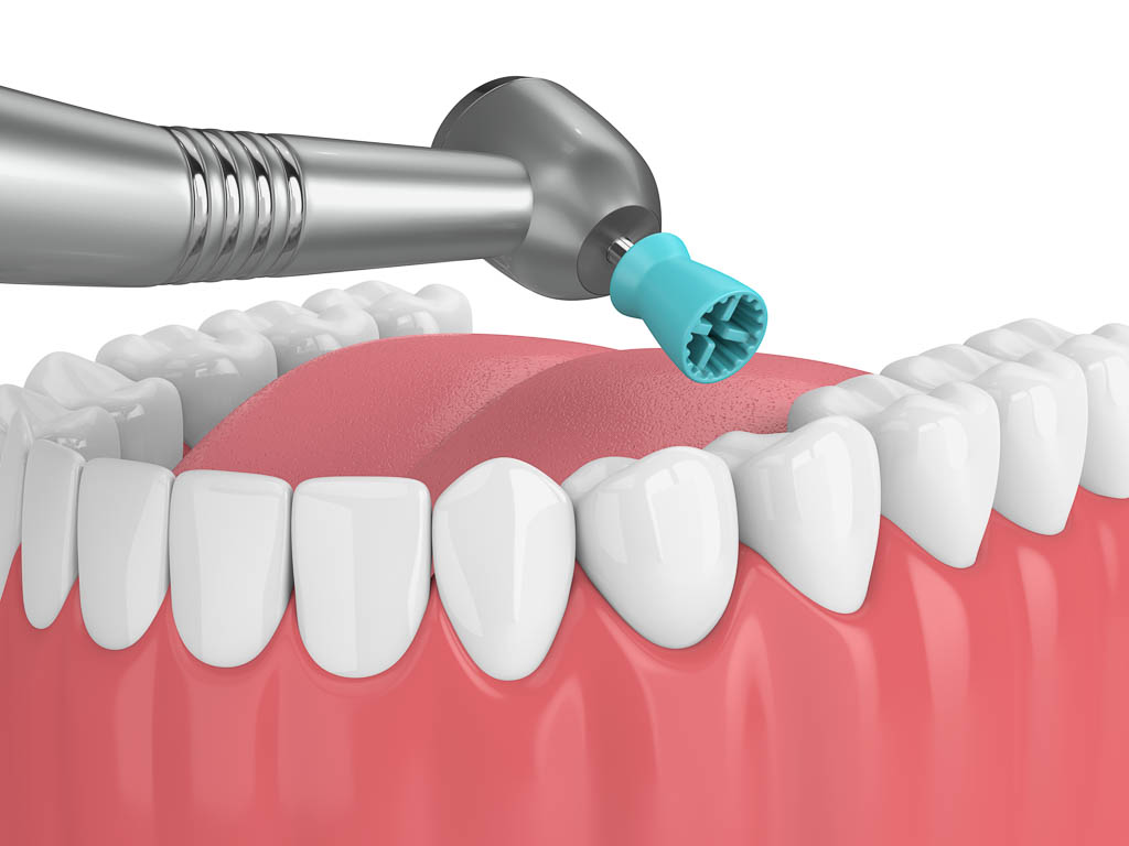 dental hygiene content